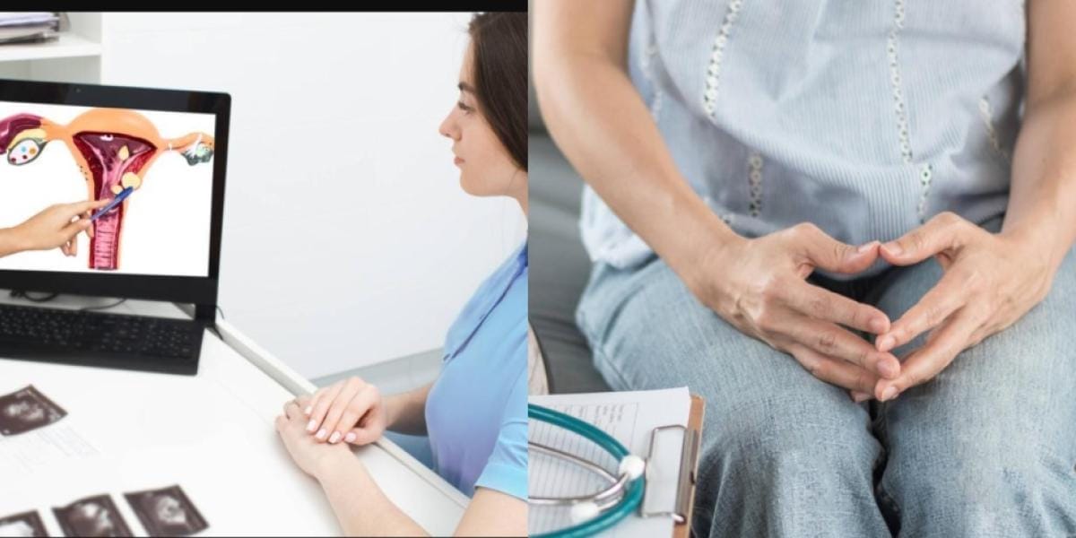 Endometriosis Una Enfermedad Silenciosa que Impacta la Calidad de Vida de las Mujeres 2
