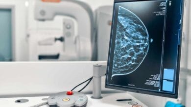 Explorando los Avances más Recientes en la Lucha Contra el Cáncer 19